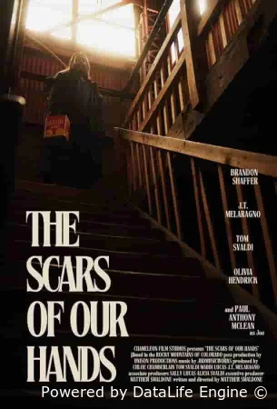 Шрамы на наших руках